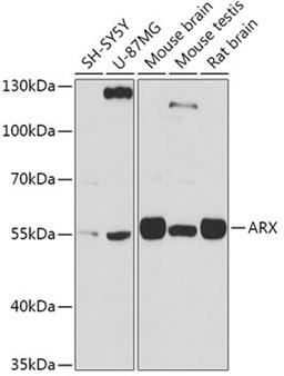 Western blot - ARX antibody (A17267)