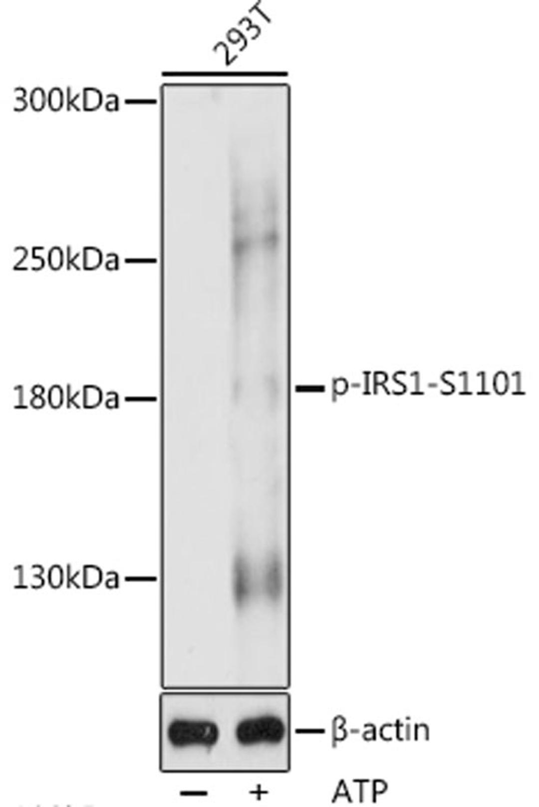 Western blot - Phospho-IRS1-S1101 antibody (AP0867)