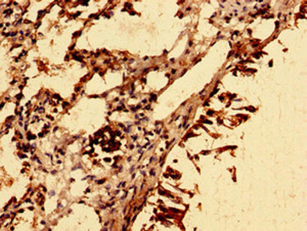 Immunohistochemistry of paraffin-embedded human lung tissue using CSB-PA021637LA01HU at dilution of 1:100