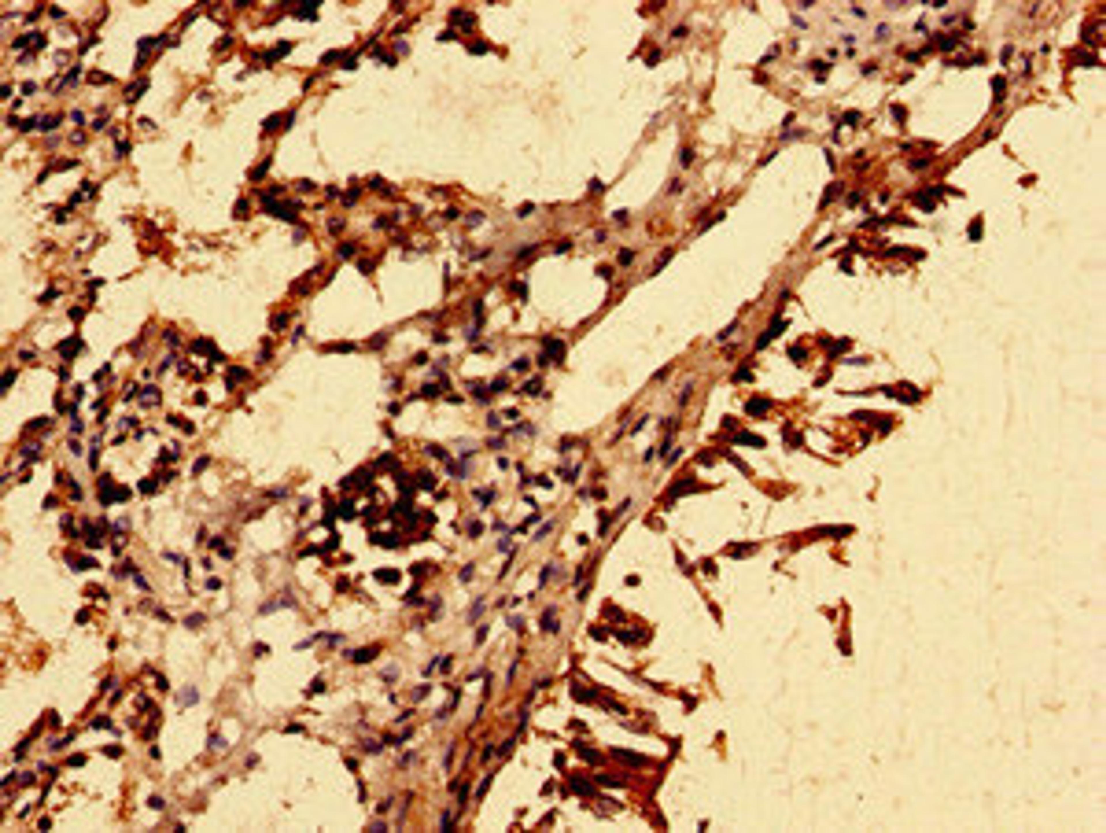 Immunohistochemistry of paraffin-embedded human lung tissue using CSB-PA021637LA01HU at dilution of 1:100