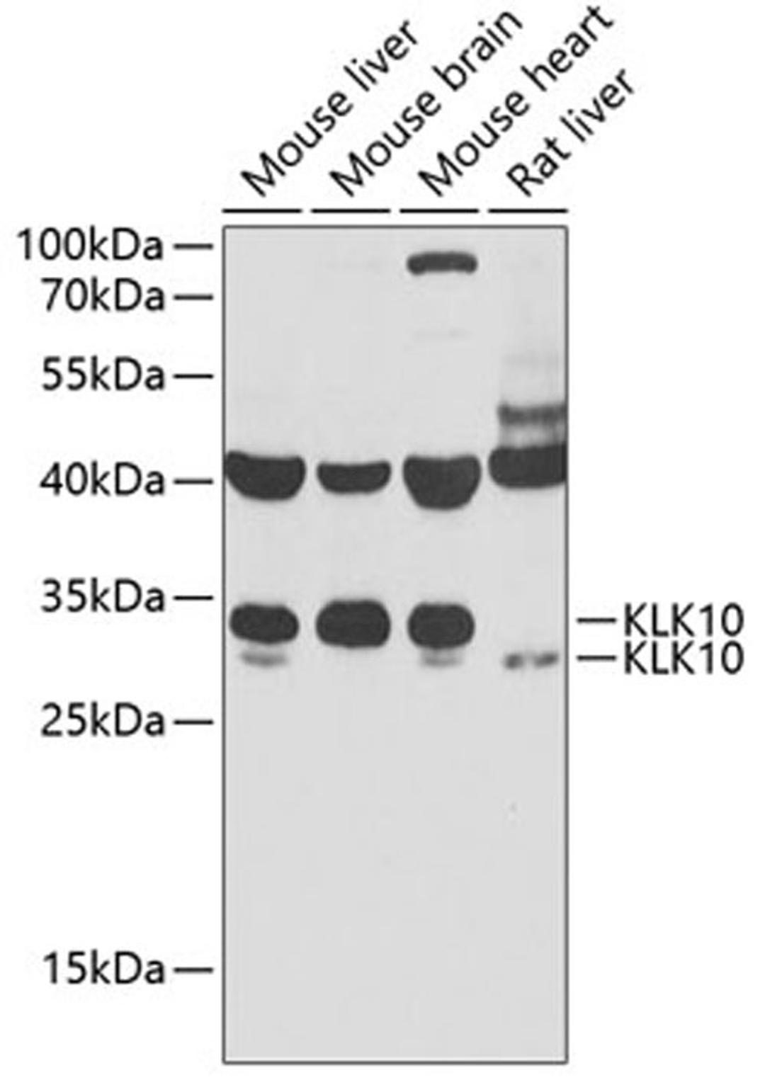 Western blot - KLK10 antibody (A6398)