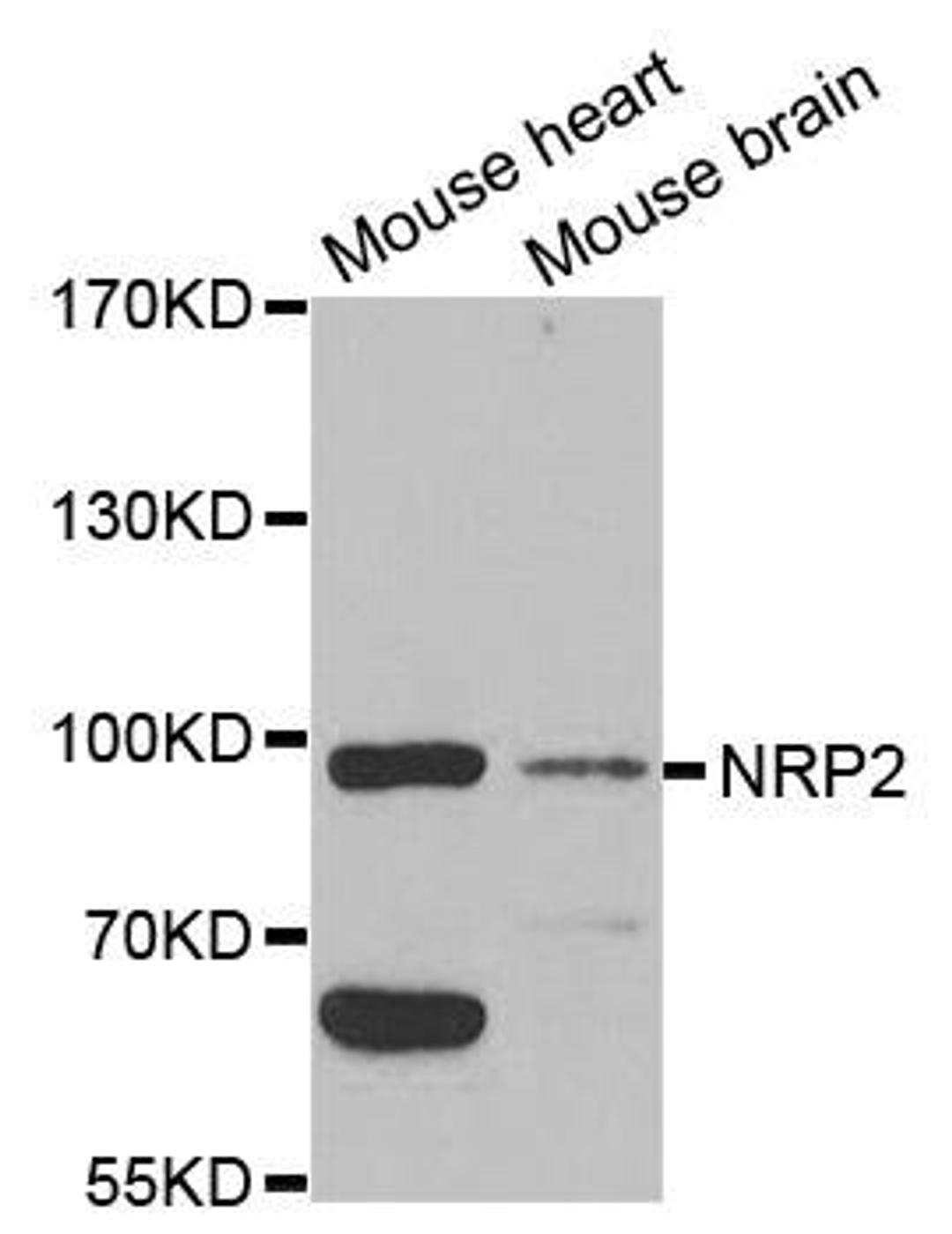 Western blot analysis of extracts of various cell lines using Neuropilin-2 antibody