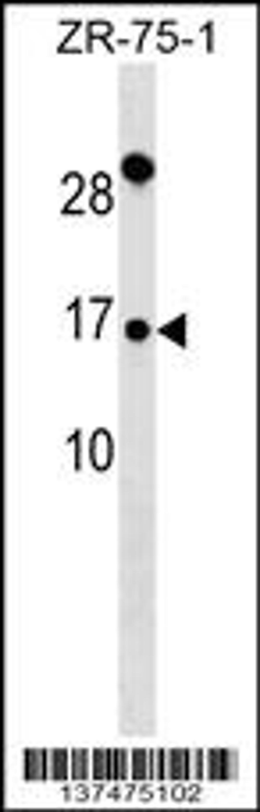 Western blot analysis in ZR-75-1 cell line lysates (35ug/lane).