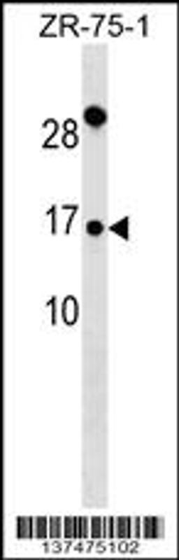 Western blot analysis in ZR-75-1 cell line lysates (35ug/lane).