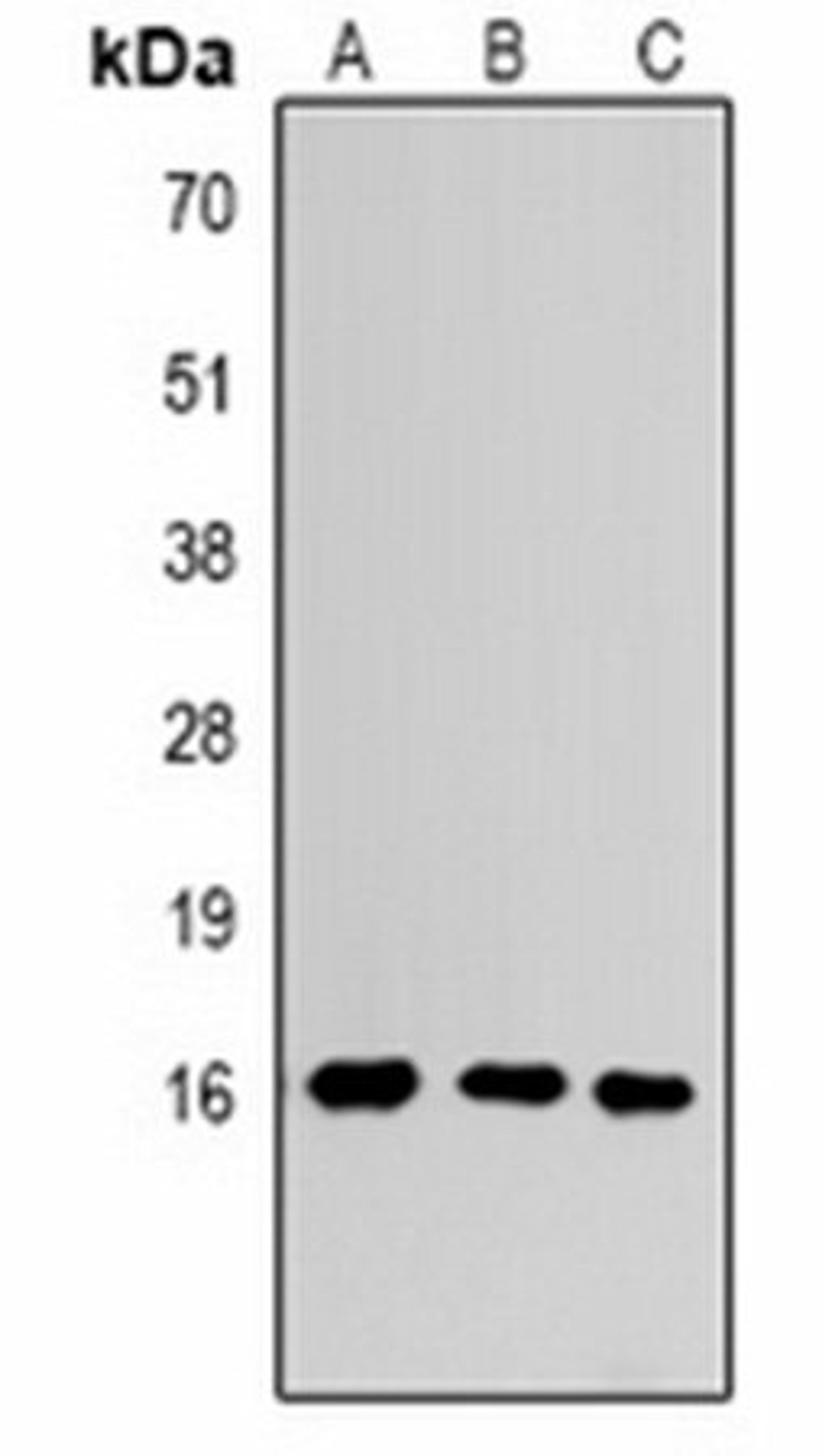 Western blot analysis of  Hela (Lane1), Raw264.7 (Lane2), rat testis (Lane3) whole cell lysates using Histone H3 (MonoMethyl K4) antibody