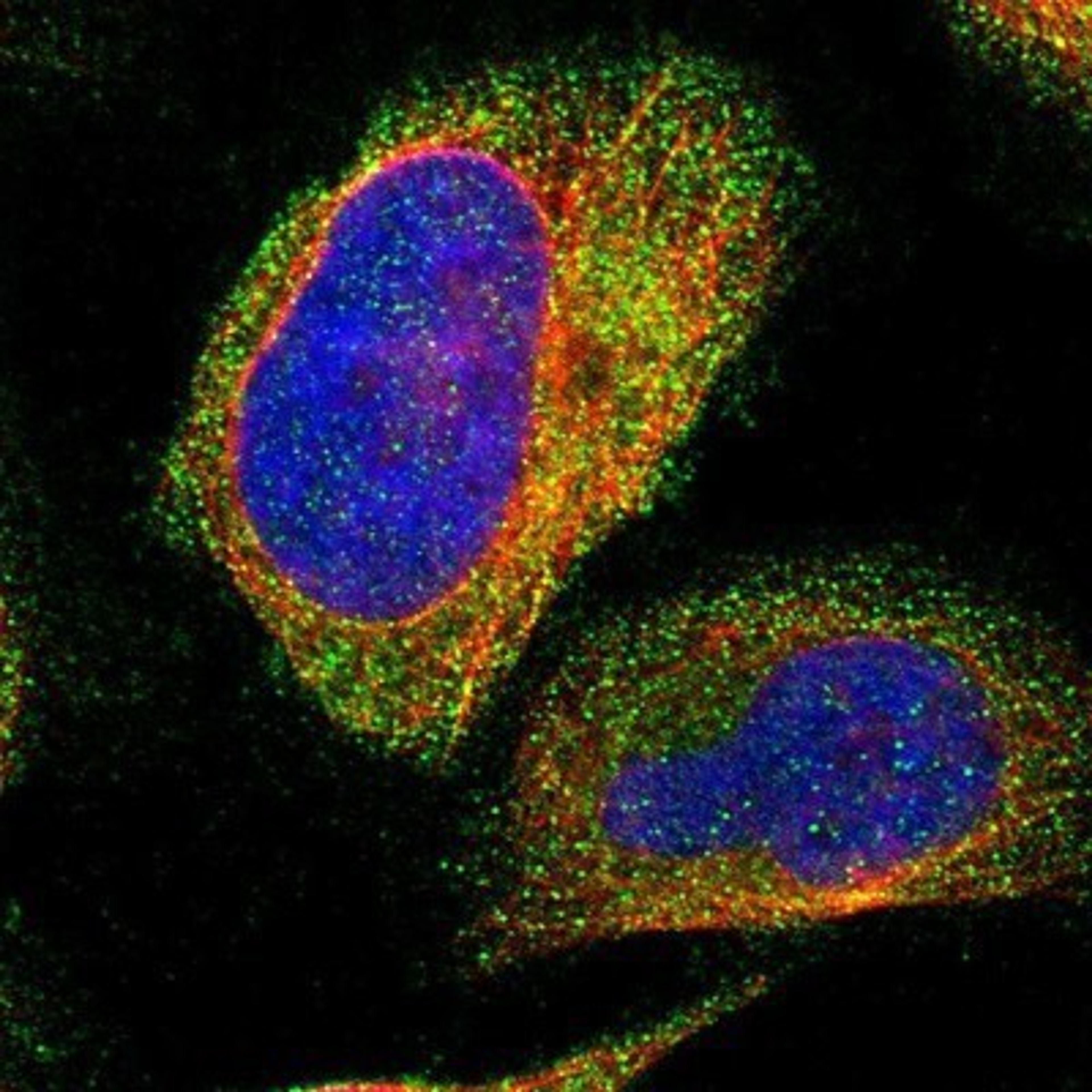 Immunocytochemistry/Immunofluorescence: NT5C Antibody [NBP1-84563] - Staining of human cell line U-2 OS shows positivity in cytoplasm.