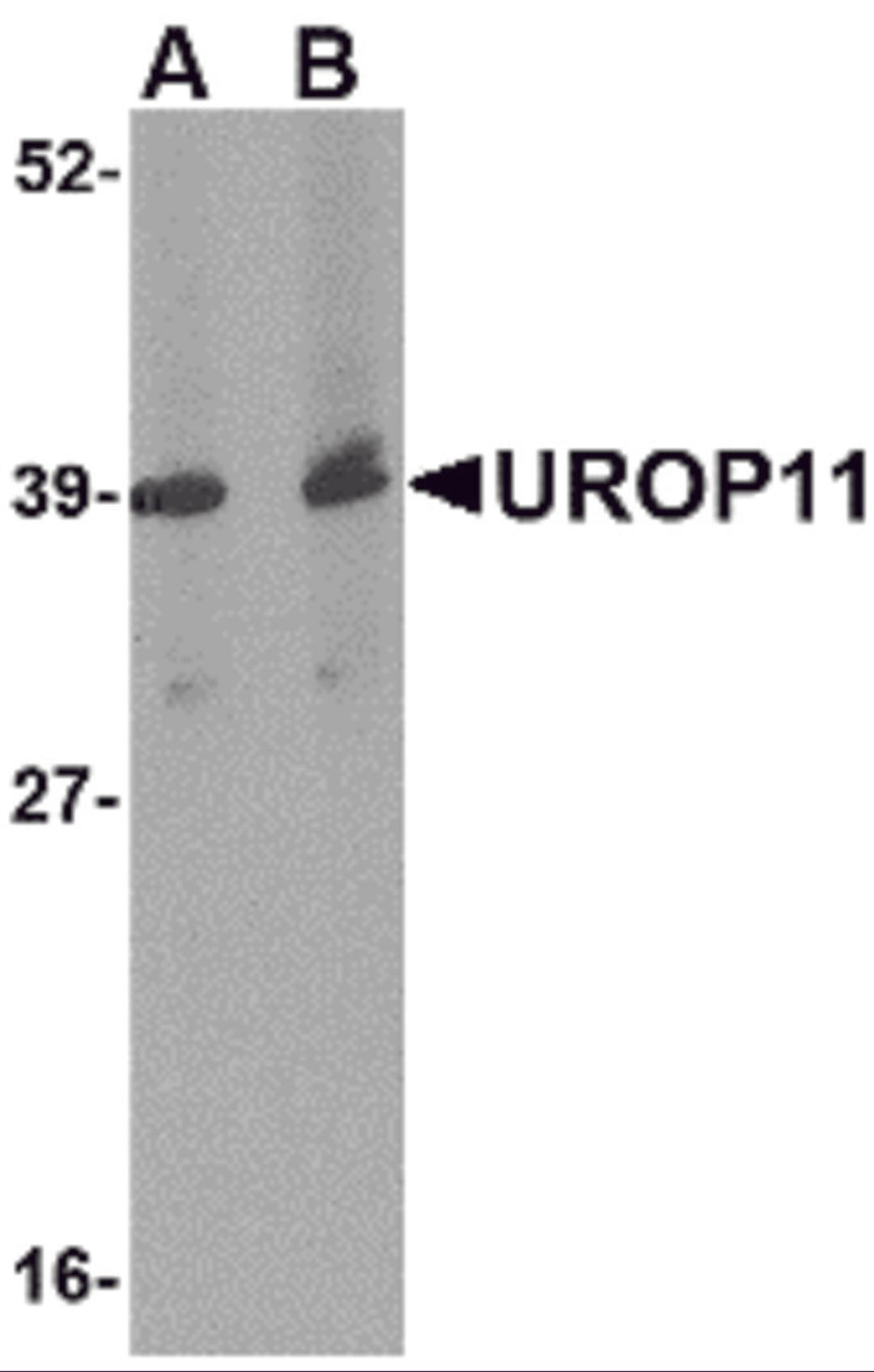 Western blot analysis of UROP11 in mouse spleen tissue lysate with UROP11 antibody at (A) 1 and (B) 2 &#956;g/mL.