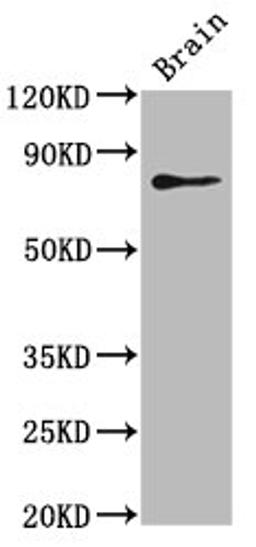 Western Blot. Positive WB detected in: Zebrafish brain tissue. All lanes: skib antibody at 5ug/ml. Secondary. Goat polyclonal to rabbit IgG at 1/50000 dilution. Predicted band size: 80 kDa. Observed band size: 80 kDa. 