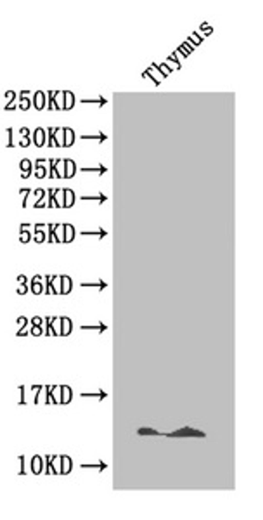 Western Blot. Positive WB detected in: Mouse thymus tissue. All lanes: B2M antibody at 4µg/ml. Secondary. Goat polyclonal to rabbit IgG at 1/50000 dilution. Predicted band size: 14 kDa. Observed band size: 14 kDa