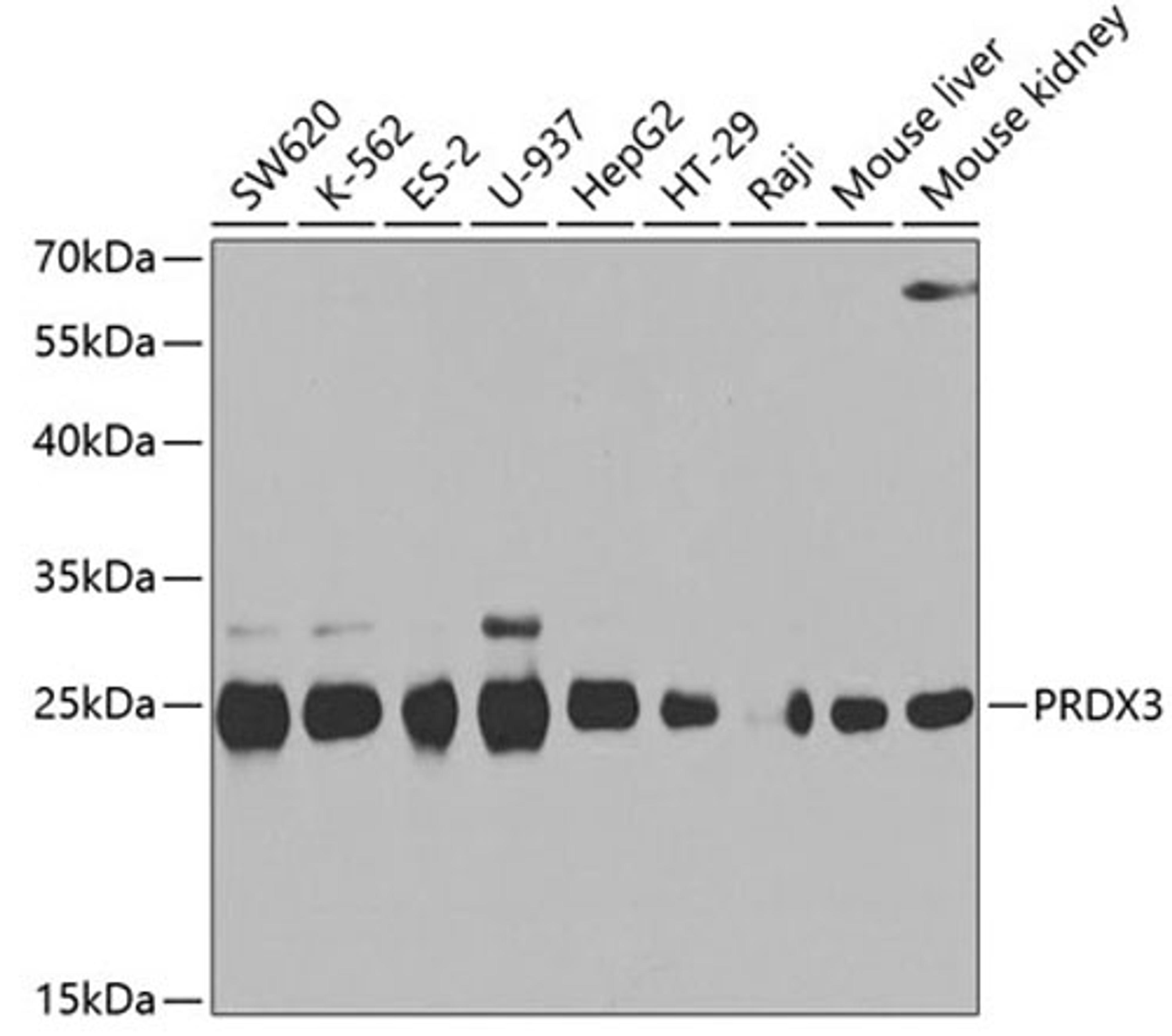 Western blot - PRDX3 antibody (A3076)