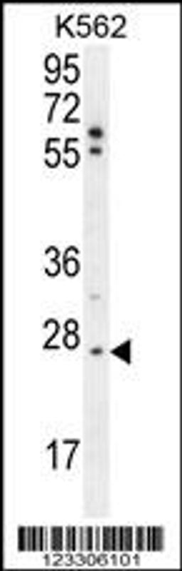 Western blot analysis in K562 cell line lysates (35ug/lane).