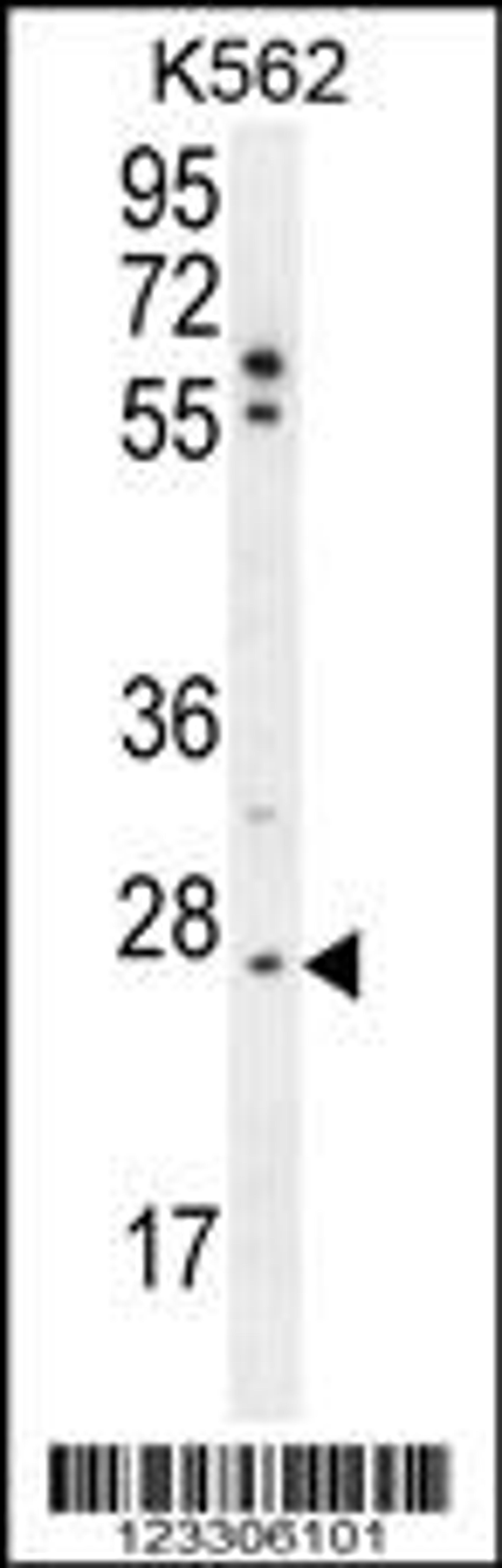 Western blot analysis in K562 cell line lysates (35ug/lane).