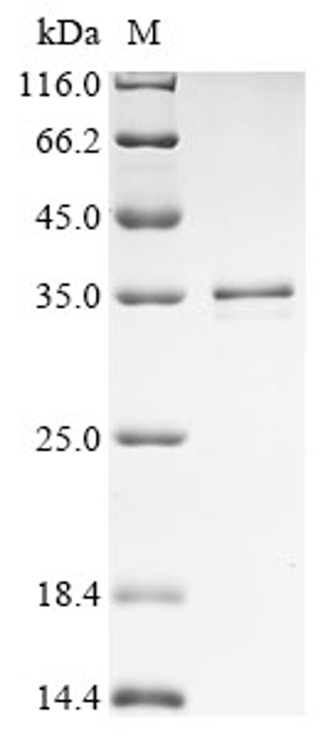(Tris-Glycine gel) Discontinuous SDS-PAGE (reduced) with 5% enrichment gel and 15% separation gel.