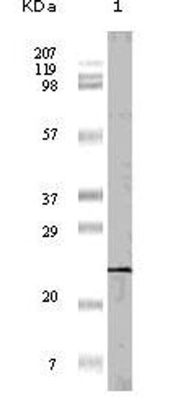 Western blot analysis using 4E - BP1 monoclonal antibody against truncated 4E - BP1 recombinant protein.