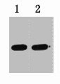 0.5ug GST fusion protein+ Primary antibody dilution at  1) 1:5000 2) 1:10000
