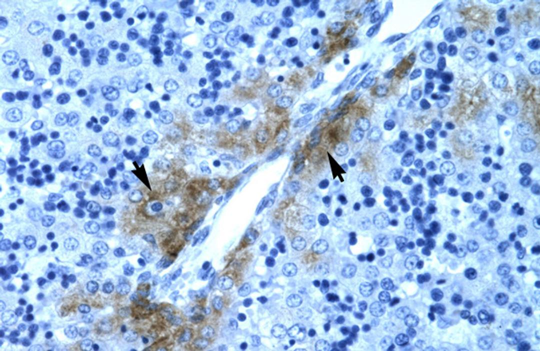 Antibody used in IHC on Human Liver at 4.0-8.0 ug/ml.