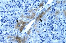 Antibody used in IHC on Human Liver at 4.0-8.0 ug/ml.