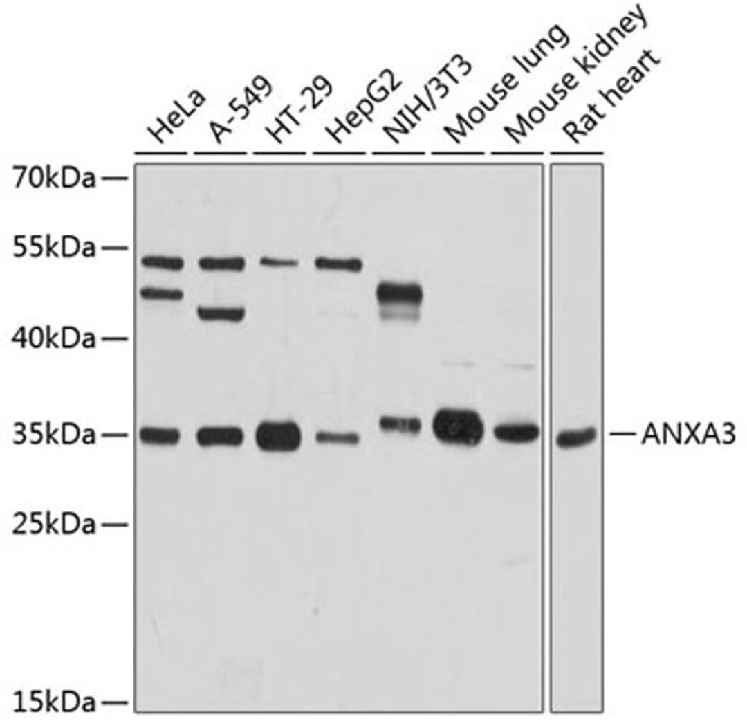 Western blot - ANXA3 antibody (A8763)