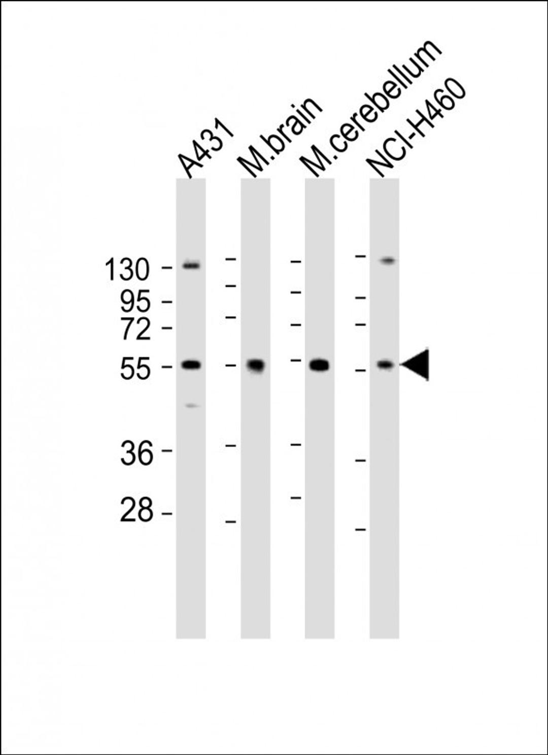 Western Blot at 1:2000 dilution Lane 1: A431 whole cell lysate Lane 2: mouse brain lysate Lane 3: mouse cerebellum lysate Lane 4: NCI-H460 whole cell lysate Lysates/proteins at 20 ug per lane.