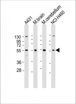 Western Blot at 1:2000 dilution Lane 1: A431 whole cell lysate Lane 2: mouse brain lysate Lane 3: mouse cerebellum lysate Lane 4: NCI-H460 whole cell lysate Lysates/proteins at 20 ug per lane.