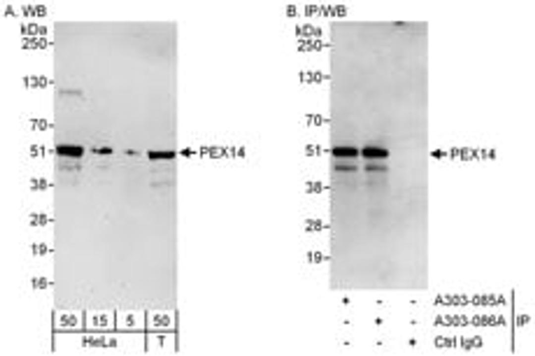 Detection of human PEX14 by western blot and immunoprecipitation.