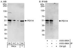 Detection of human PEX14 by western blot and immunoprecipitation.