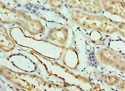 Immunohistochemistry of paraffin-embedded human kidney tissue using CSB-PA896480ESR2HU at dilution of 1:100