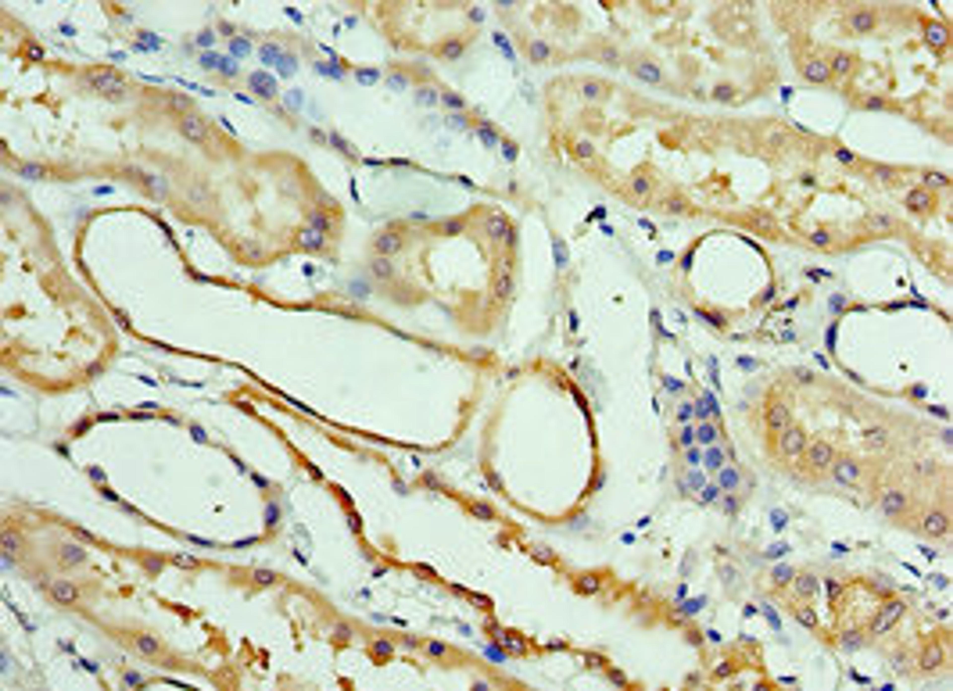 Immunohistochemistry of paraffin-embedded human kidney tissue using CSB-PA896480ESR2HU at dilution of 1:100