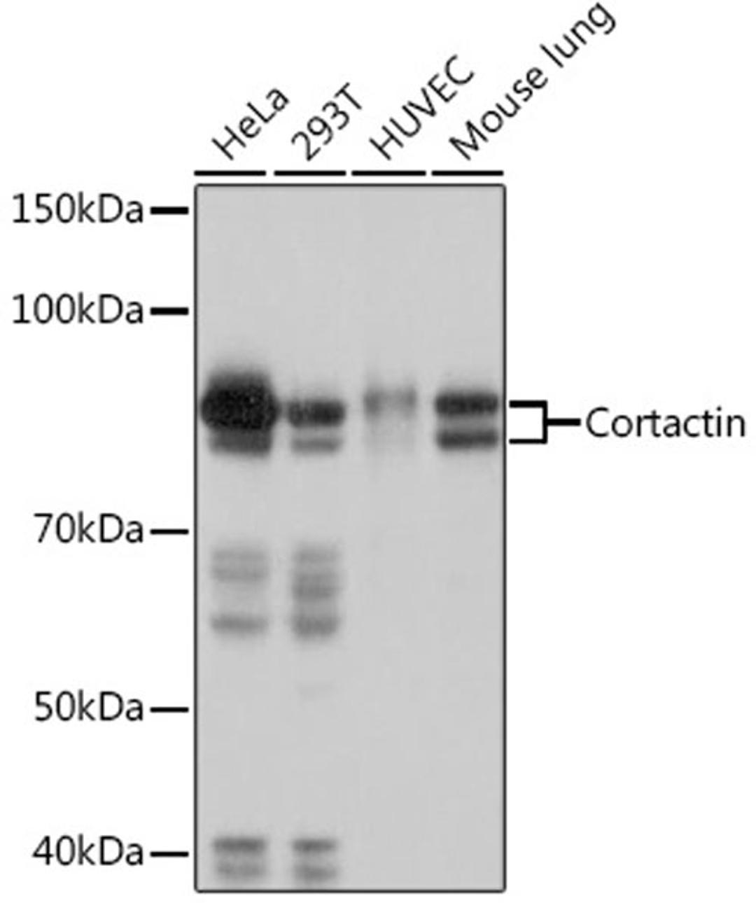 Western blot - Cortactin Rabbit mAb (A9518)