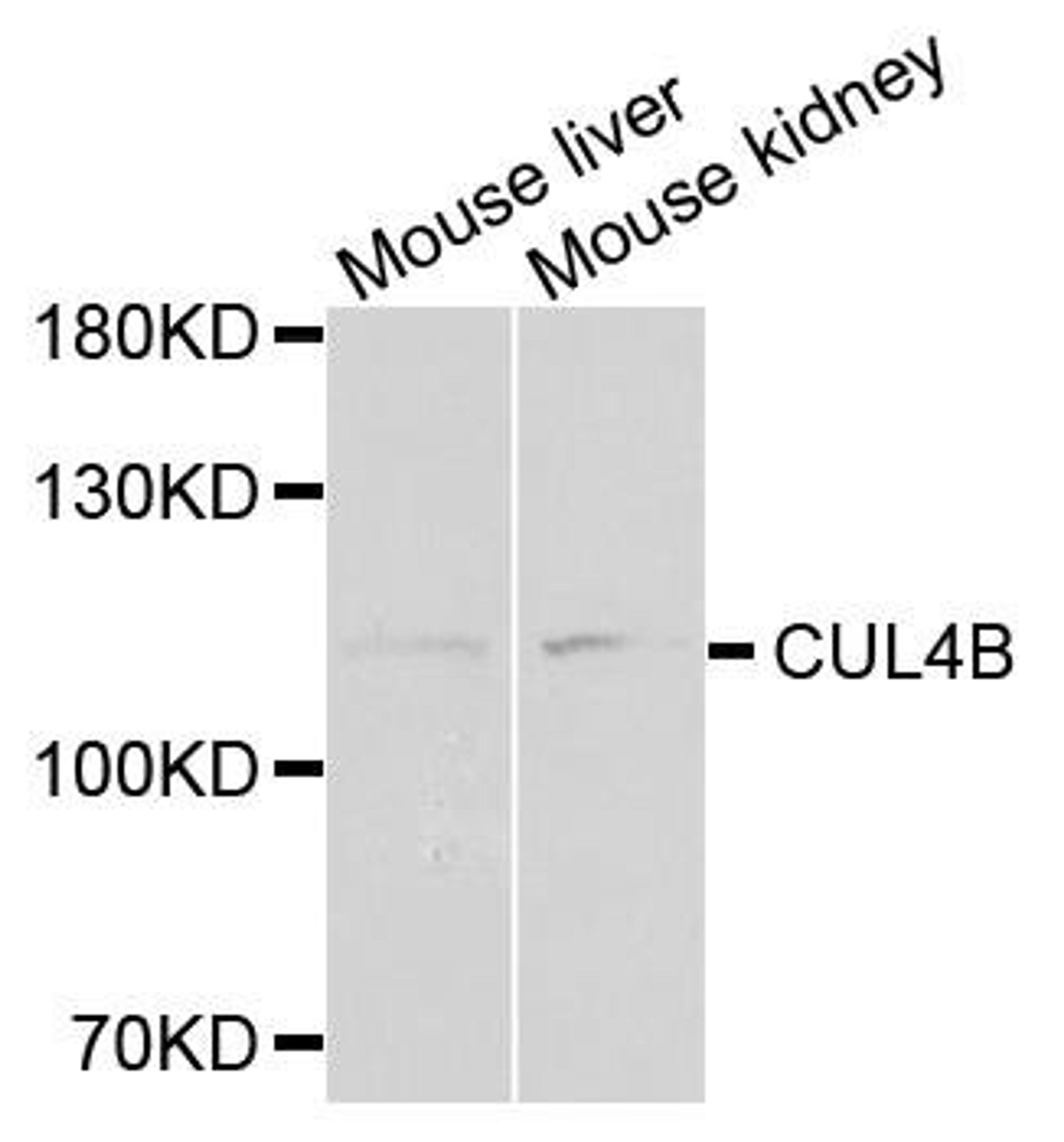 Western blot analysis of extracts of mouse tissues using CUL4B antibody