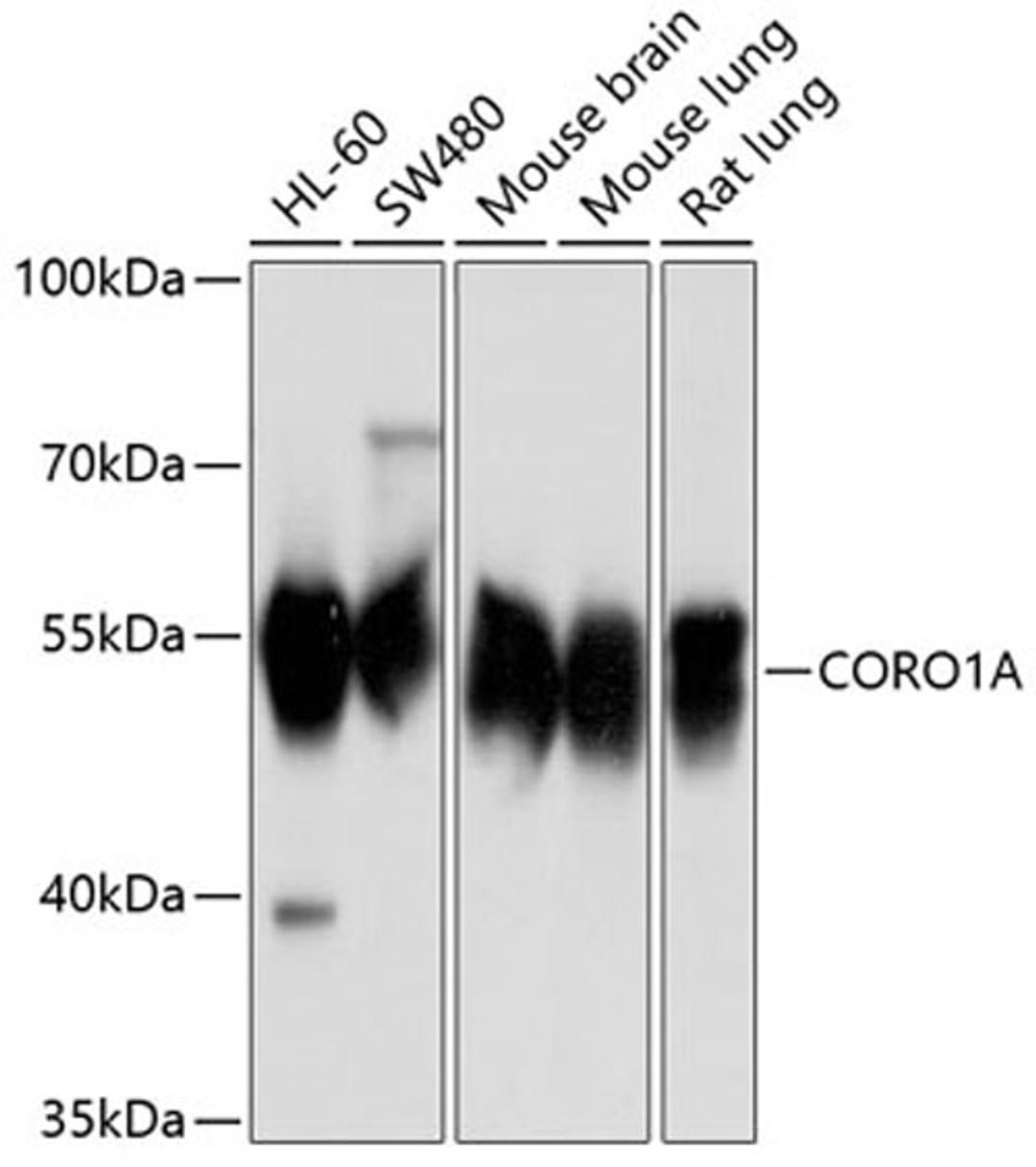 Western blot - CORO1A antibody (A9300)