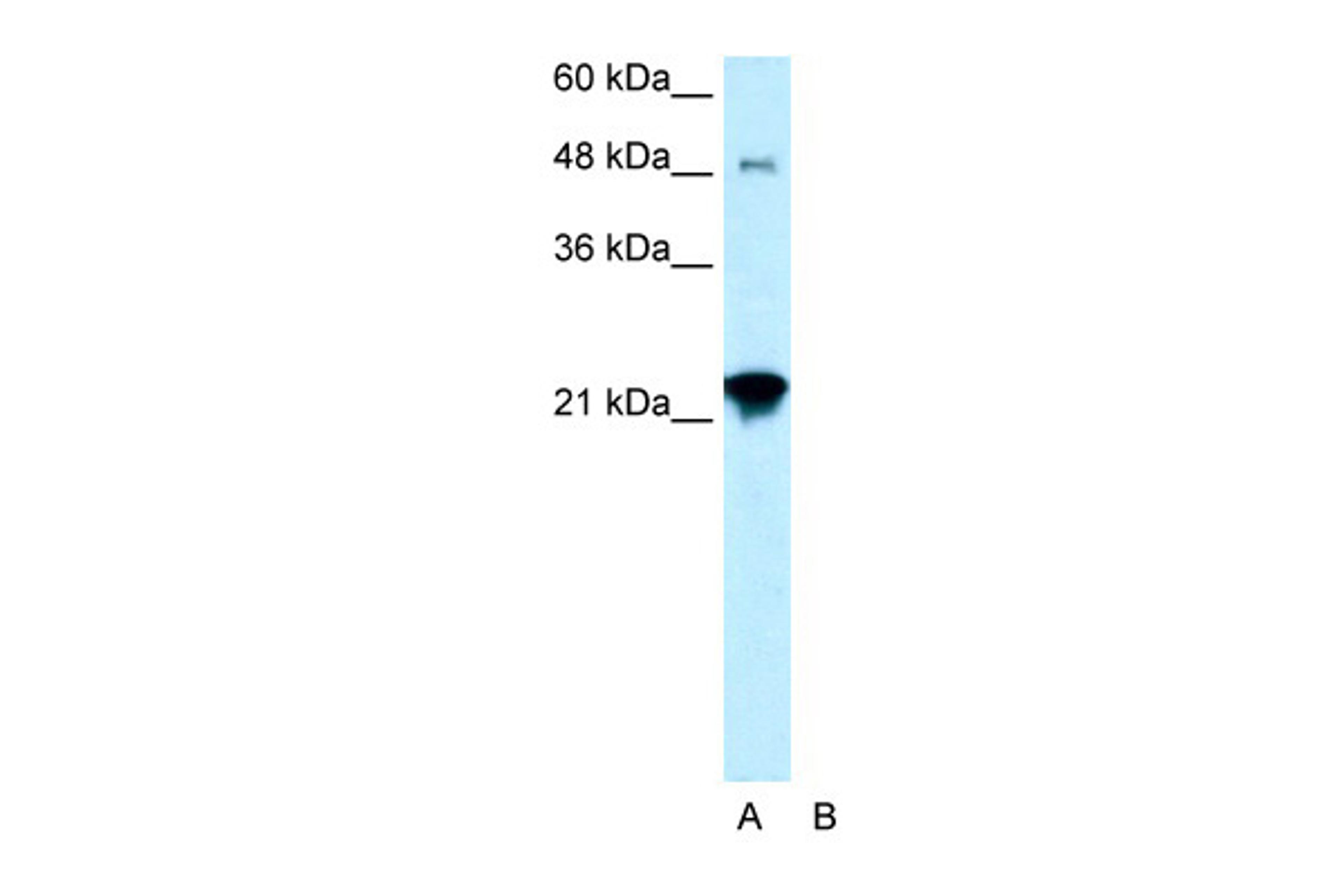 Antibody used in WB on Human HepG2 at 0.2-1 ug/ml.