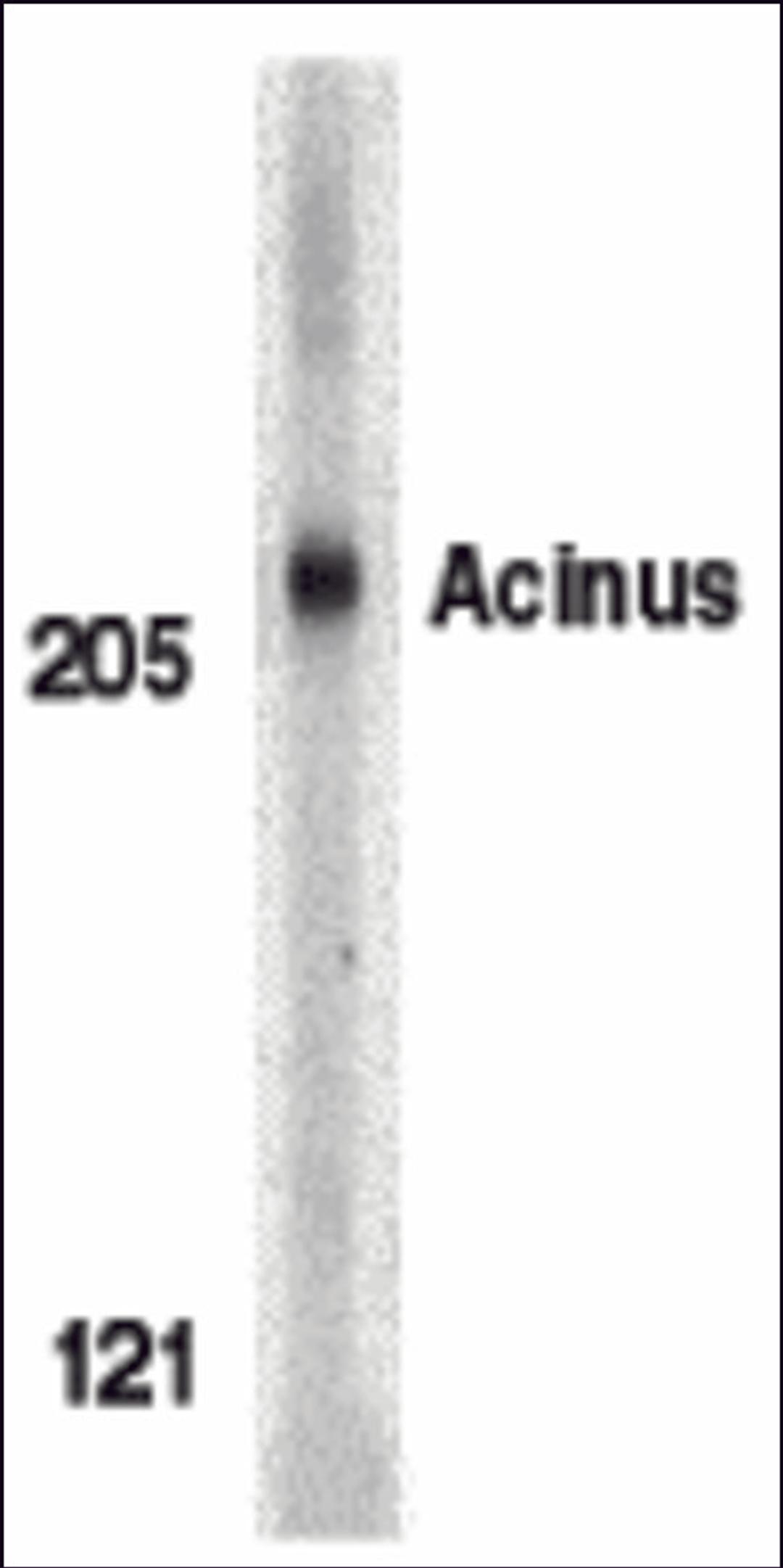 Western blot analysis of Acinus in K562 whole cell lysate with Acinus antibody (IN) at 1 &#956;g/mL.