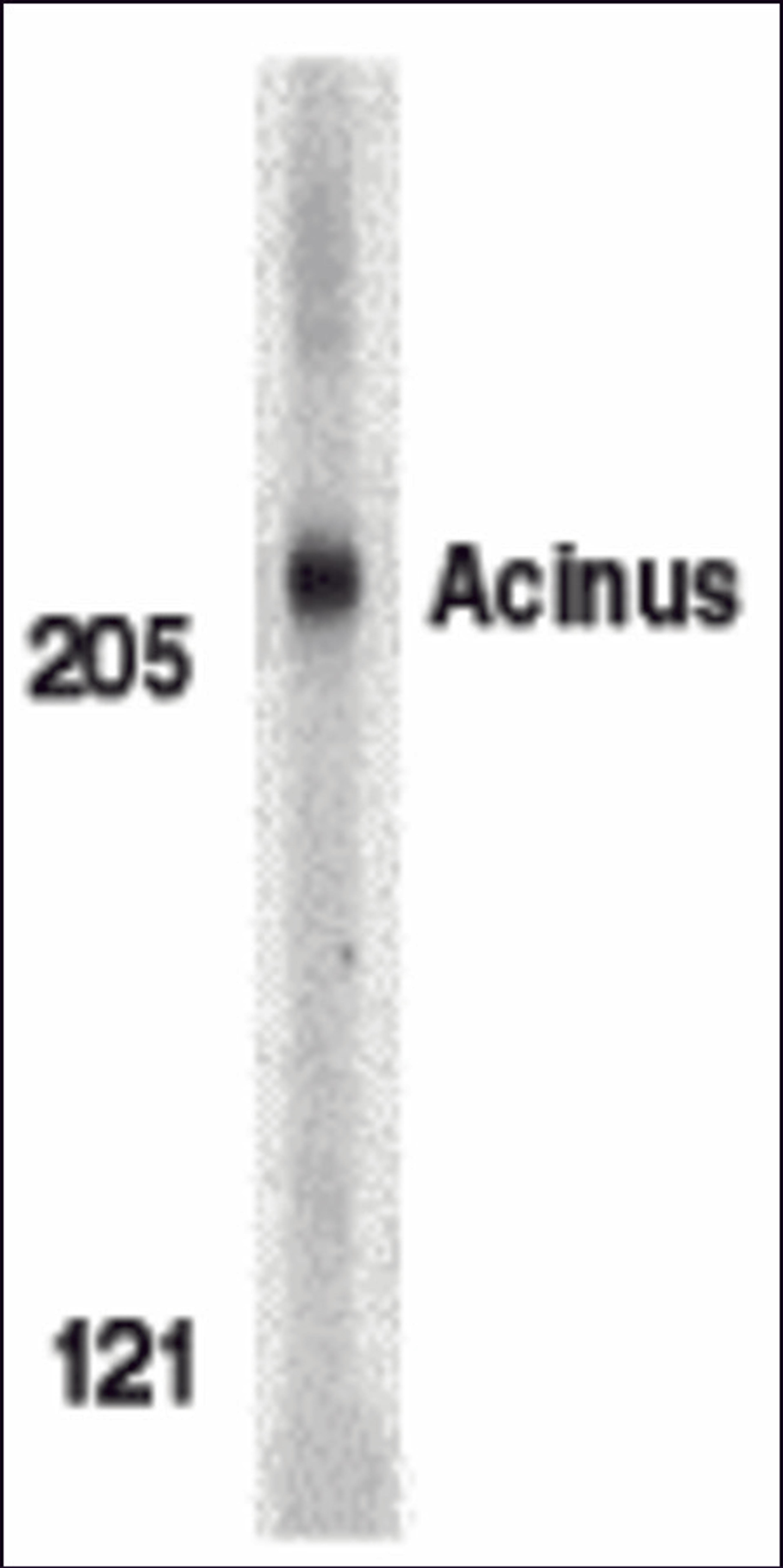 Western blot analysis of Acinus in K562 whole cell lysate with Acinus antibody (IN) at 1 &#956;g/mL.