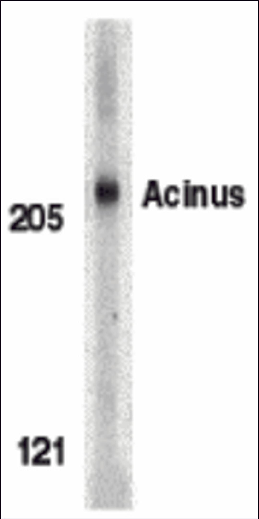 Western blot analysis of Acinus in K562 whole cell lysate with Acinus antibody (IN) at 1 μg/mL.