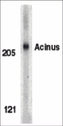 Western blot analysis of Acinus in K562 whole cell lysate with Acinus antibody (IN) at 1 μg/mL.