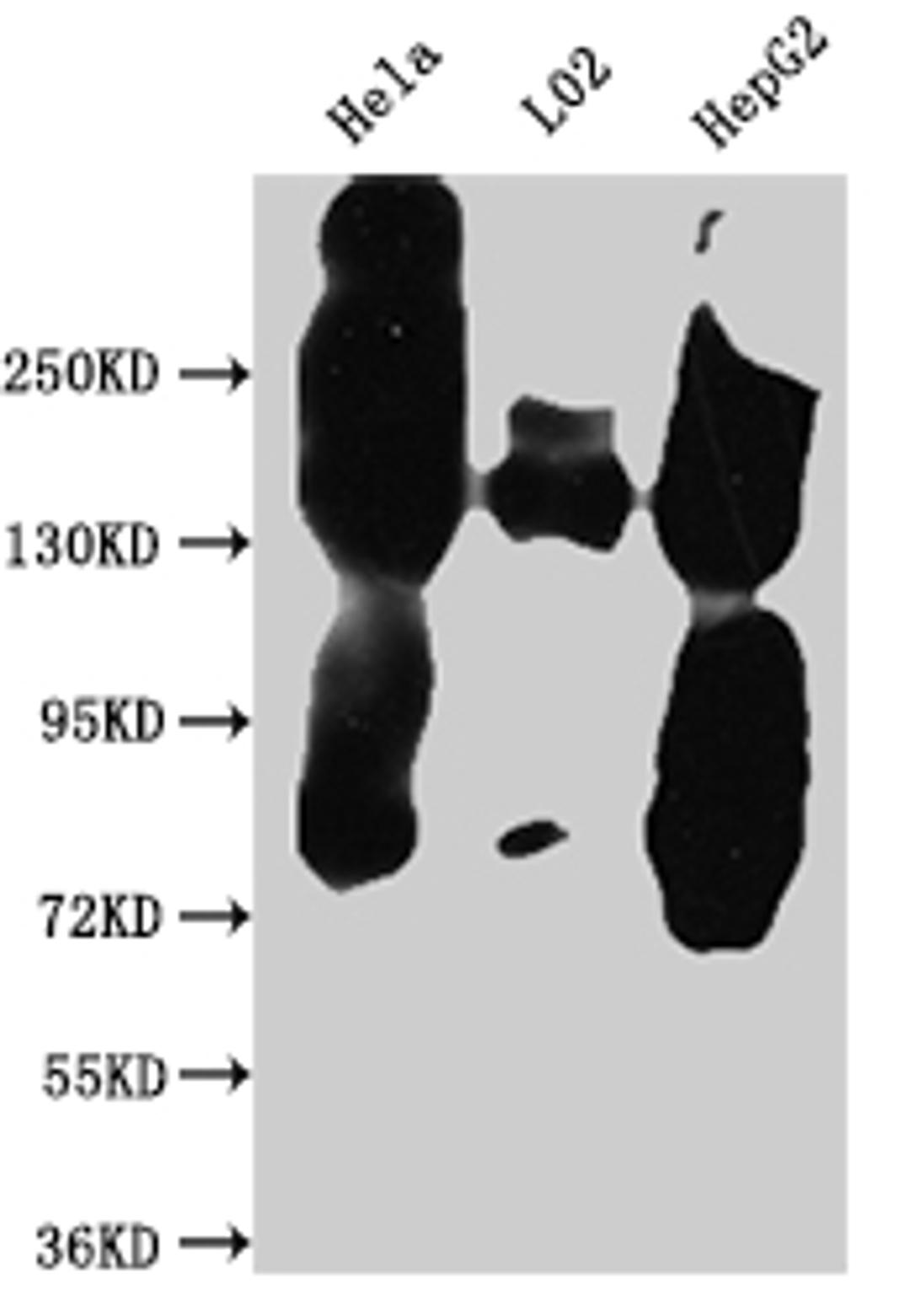 Western Blot. Positive WB detected in: Hela whole cell lysate, L02 whole cell lysate, HepG2 whole cell lysate. All lanes: EGFR antibody at 1:1000. Secondary. Goat polyclonal to rabbit IgG at 1/50000 dilution. Predicted band size: 135, 45, 78, 70 kDa. Observed band size: 150 kDa. 
