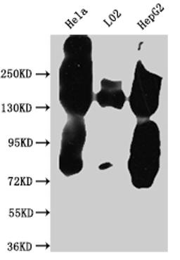 Western Blot. Positive WB detected in: Hela whole cell lysate, L02 whole cell lysate, HepG2 whole cell lysate. All lanes: EGFR antibody at 1:1000. Secondary. Goat polyclonal to rabbit IgG at 1/50000 dilution. Predicted band size: 135, 45, 78, 70 kDa. Observed band size: 150 kDa. 