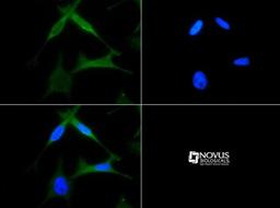 Immunocytochemistry/Immunofluorescence: CXCR4 Antibody [NB100-74396] - CXCR4 antibody was tested in HeLa cells with FITC (green). Nuclei were counterstained with DAPI (blue).