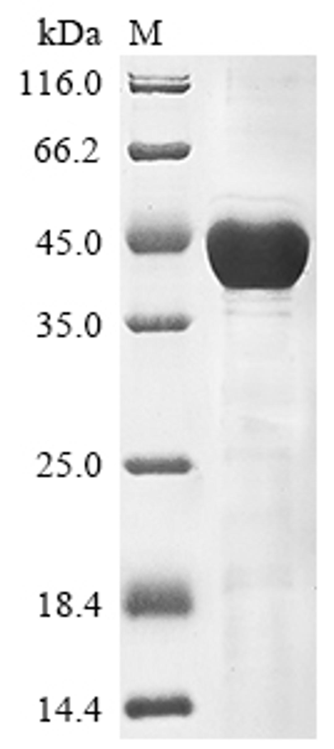 (Tris-Glycine gel) Discontinuous SDS-PAGE (reduced) with 5% enrichment gel and 15% separation gel.