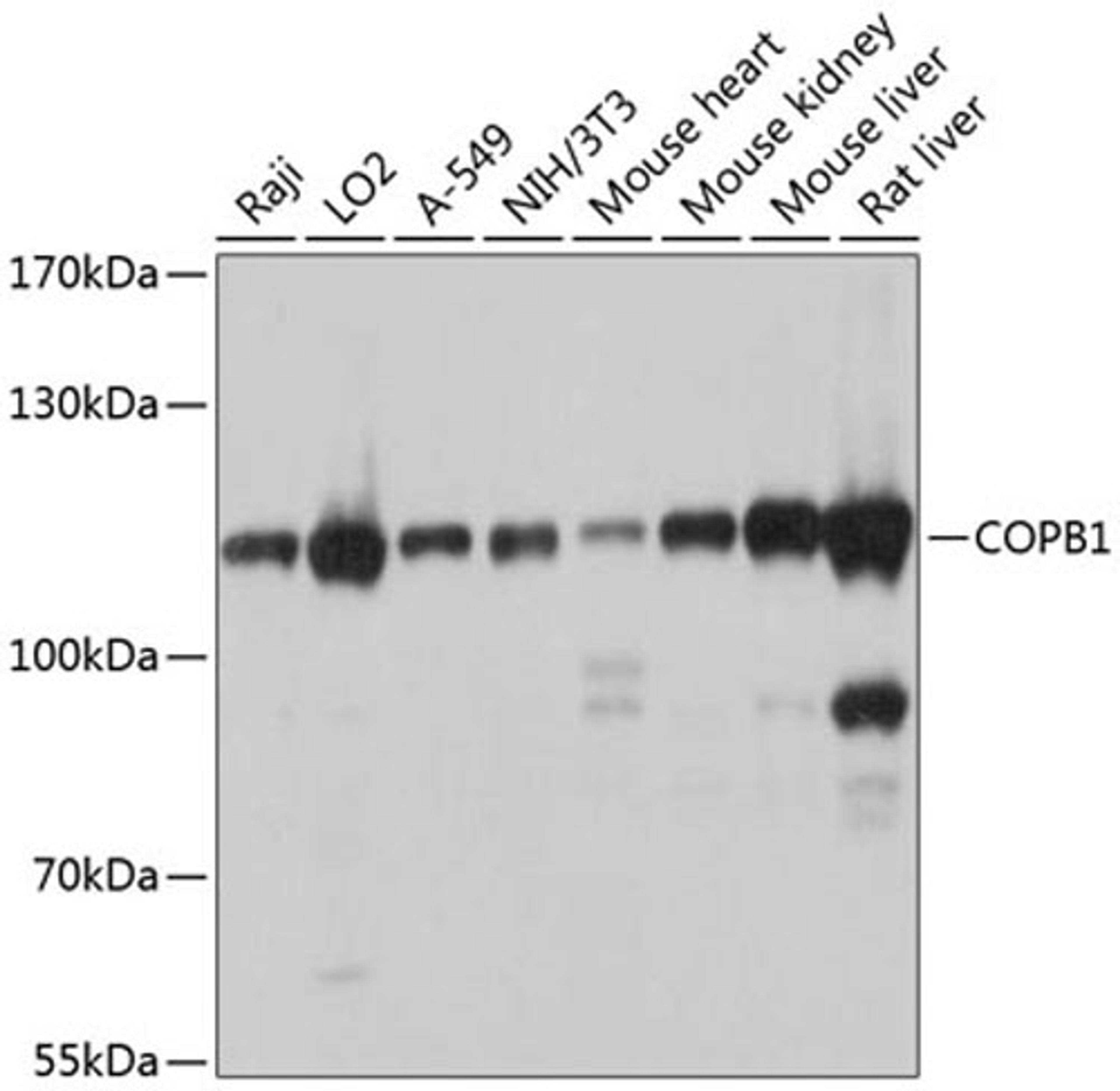 Western blot - COPB1 antibody (A10485)