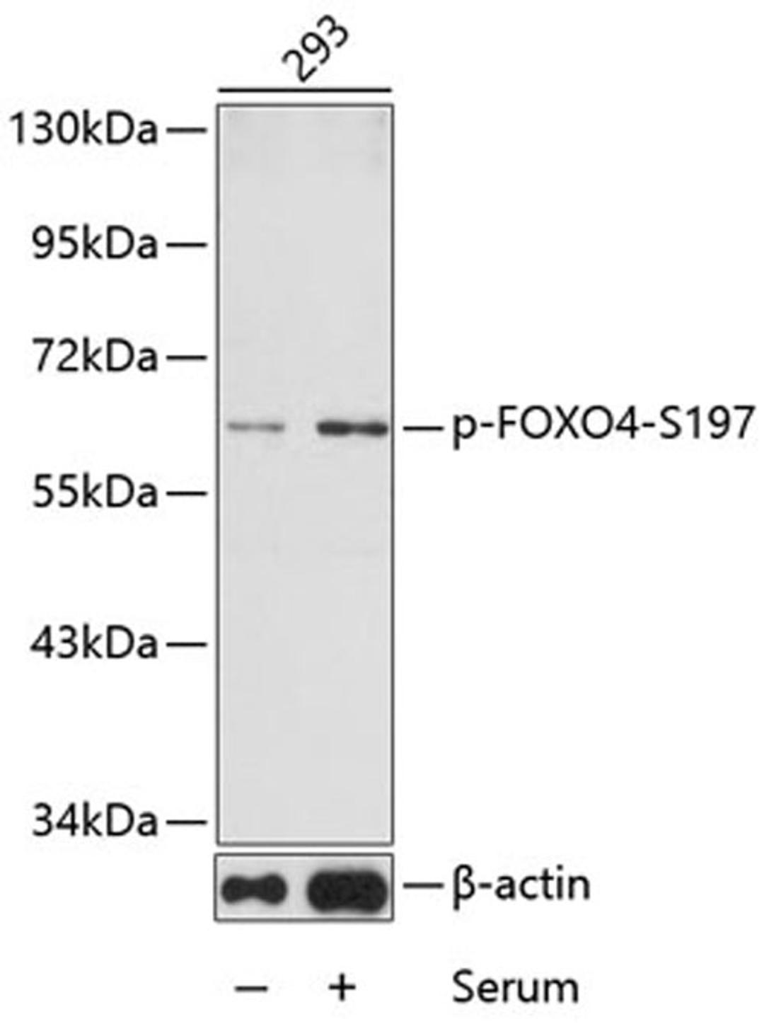 Western blot - phospho-FOXO4-S197 antibody (AP0177)