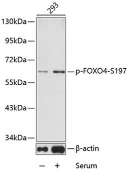 Western blot - phospho-FOXO4-S197 antibody (AP0177)