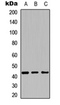 Western blot analysis of HEK293T (Lane 1), NIH3T3 (Lane 2), PC12 (Lane 3) whole cell lysates using Cytochrome P450 27C1 antibody