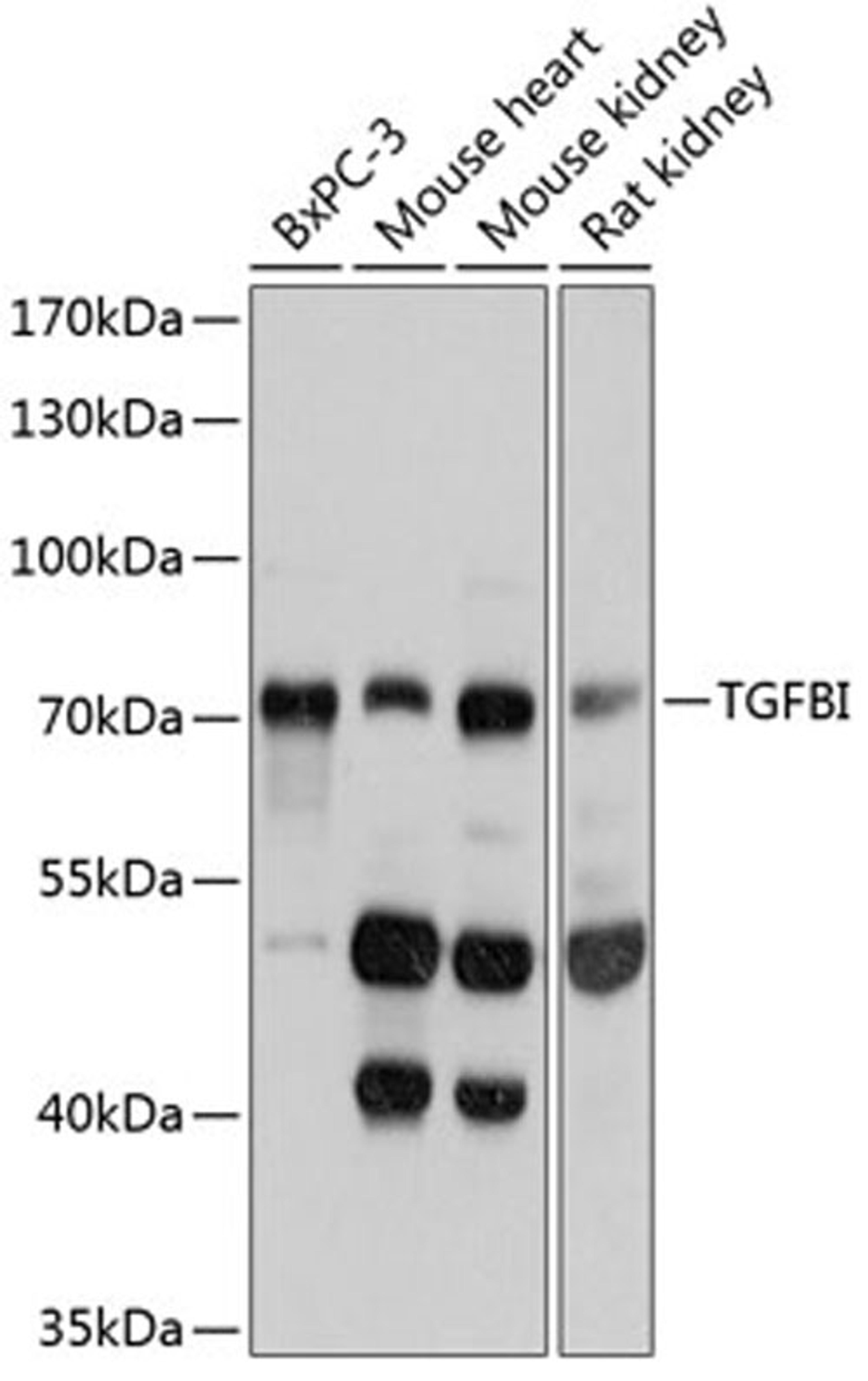 Western blot - TGFBI antibody (A11222)