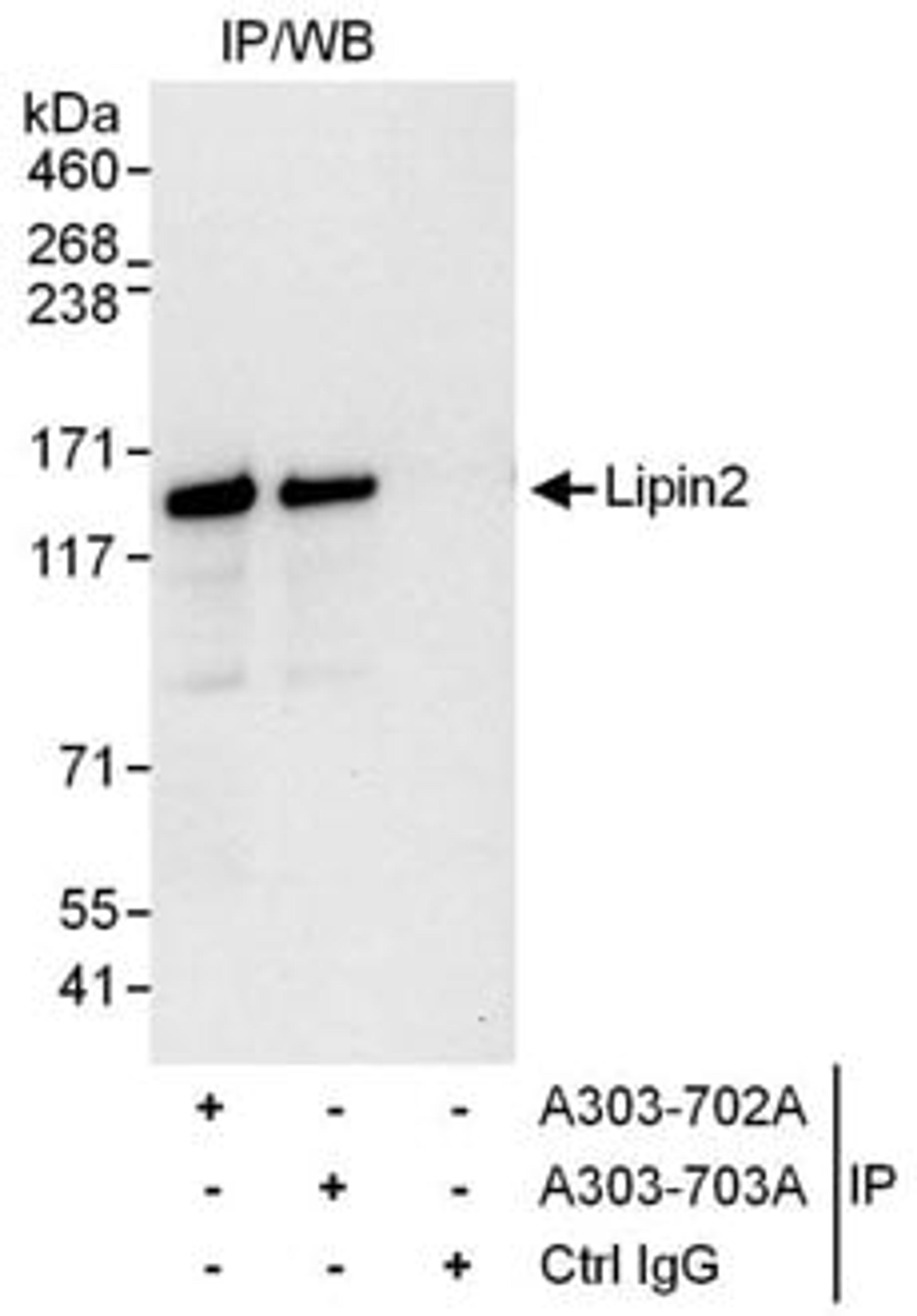 Detection of human Lipin2 by western blot of immunoprecipitates.