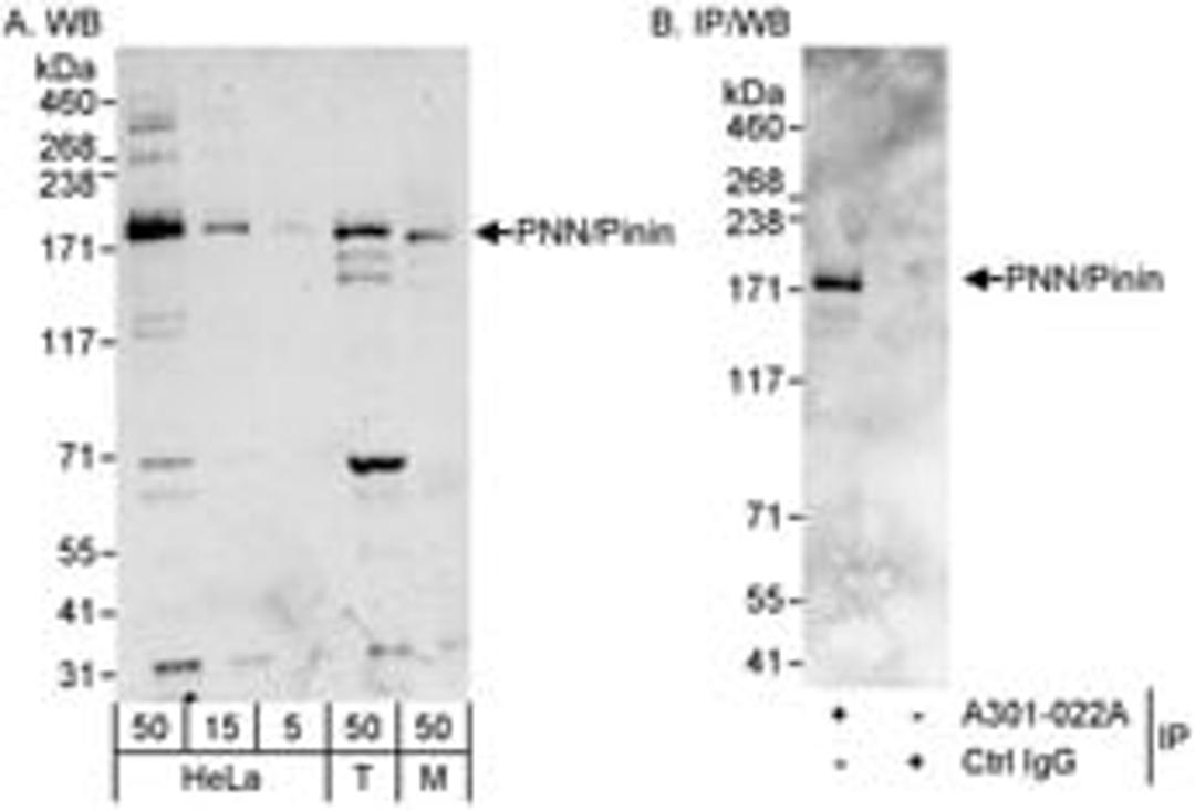 Detection of human and mouse PNN/Pinin by western blot (h&m) and immunoprecipitation (h).