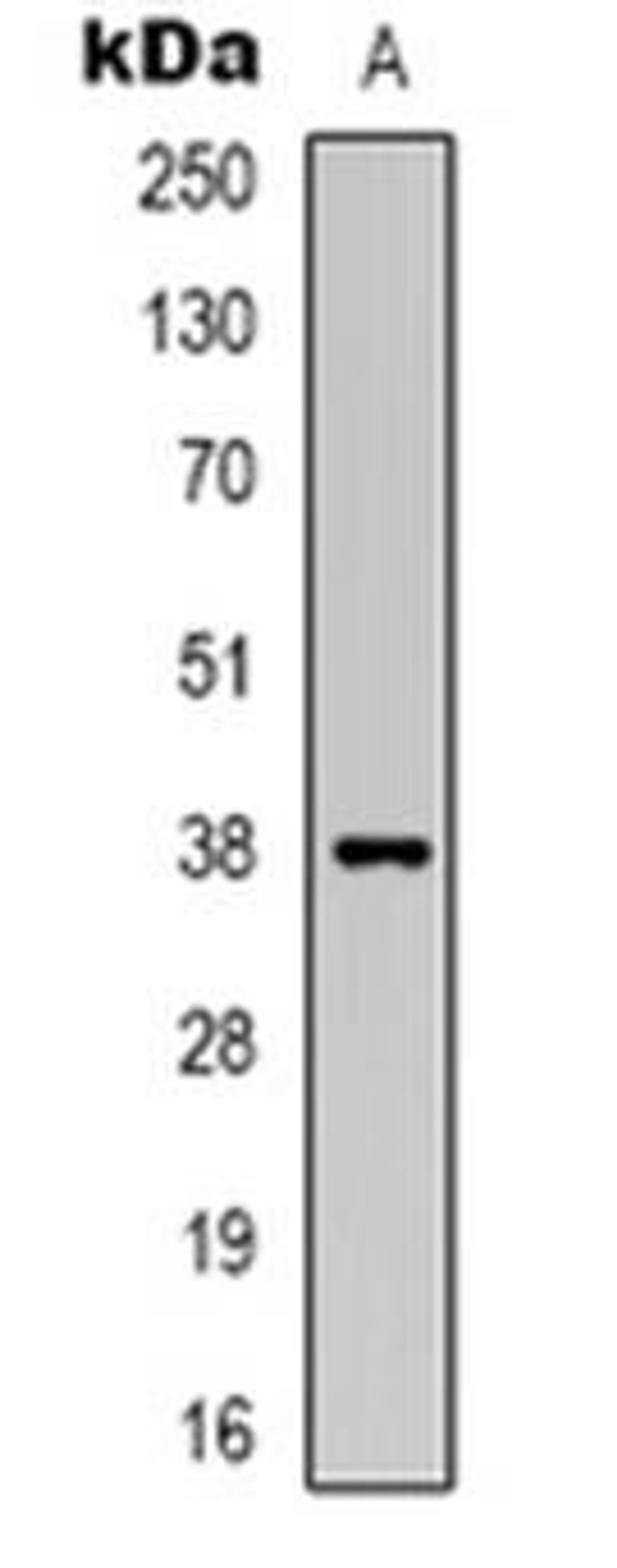 Western blot analysis of DNAJB4 expression in Jurkat (Lane 1) whole cell lysates using DNAJB4 antibody