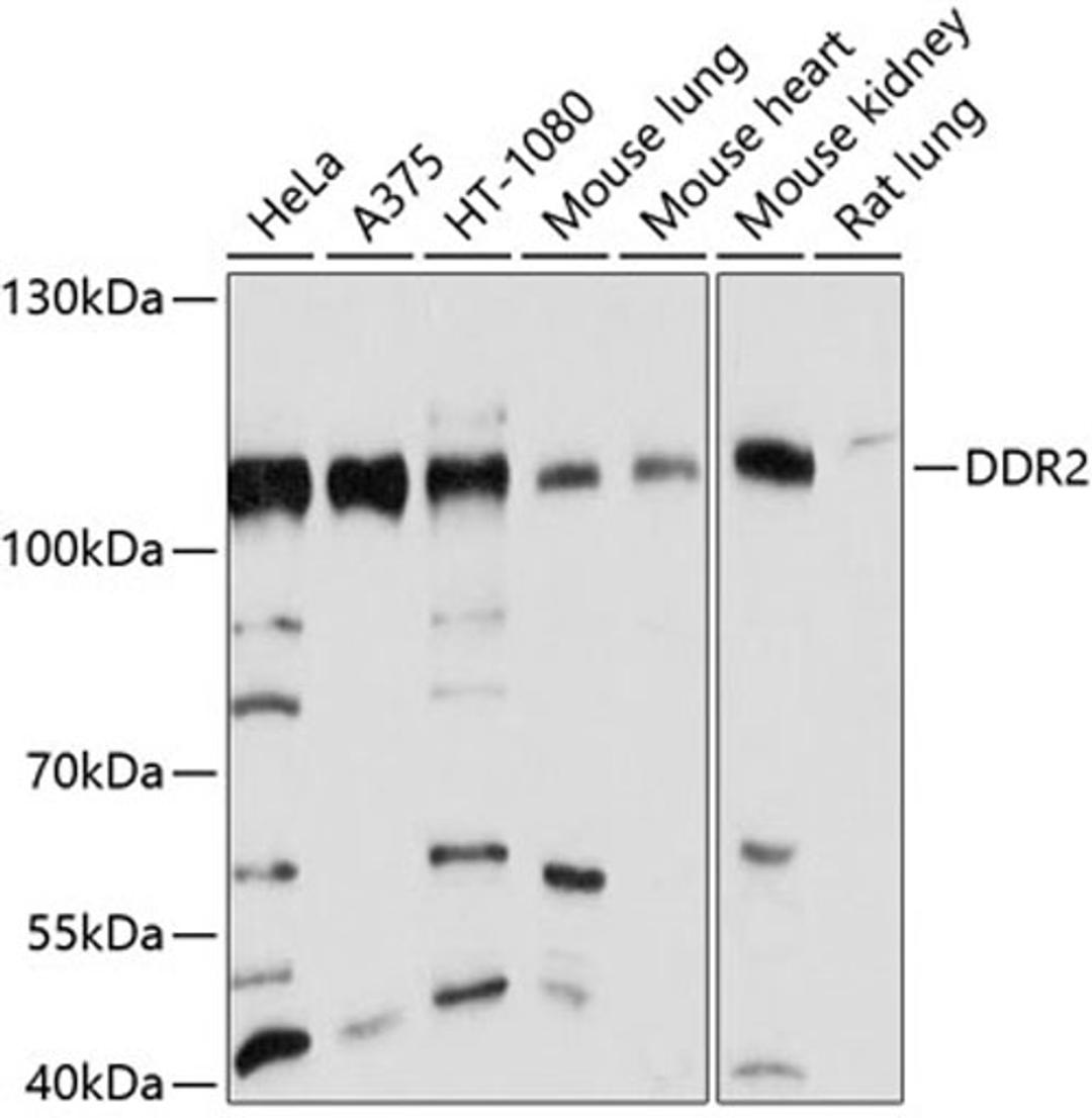 Western blot - DDR2 antibody (A10060)