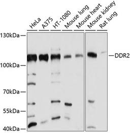 Western blot - DDR2 antibody (A10060)